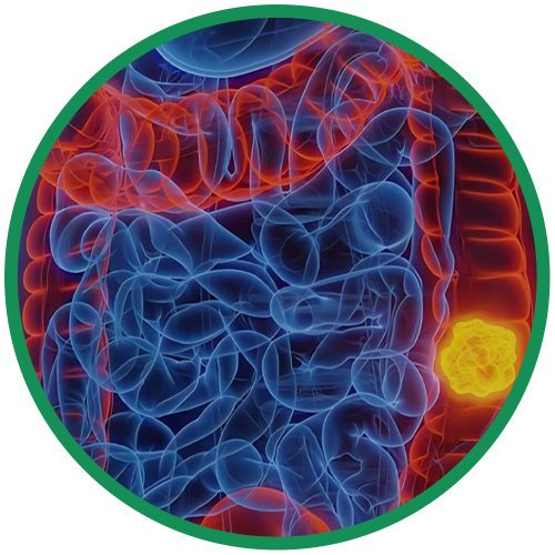 Dra. Rosana Schechter, Gastroenterologista especialista em Motilidade digestiva - Cancer de colon