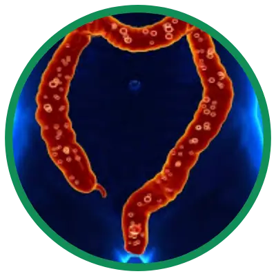 Dra. Rosana Schechter, Gastroenterologista especialista em Motilidade digestiva - Diverticulose
