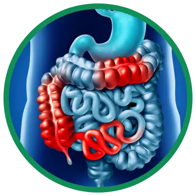 Dra. Rosana Schechter, Gastroenterologista especialista em Motilidade digestiva - Doença de Crohn