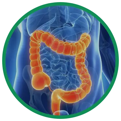 Dra. Rosana Schechter, Gastroenterologista especialista em Motilidade digestiva - Retocolite ulcerativa