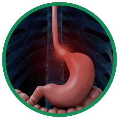 Dra. Rosana Schechter, Gastroenterologista especialista em Motilidade digestiva - esofagite de refluxo