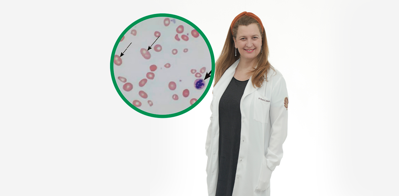 Vitamin B12 Deficiency